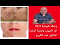 وصفة طبيعية لازالة اثر الحبوب وتنقية البشرة الدكتور عبد الكريم العابد العلوي 
