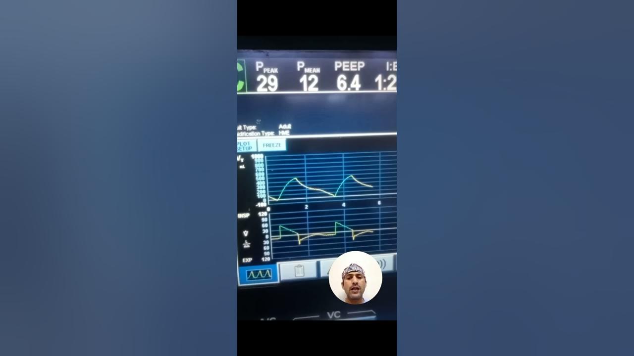 AUTO PEEP graph in purritan 840 ventilator in urdu / Hindhi