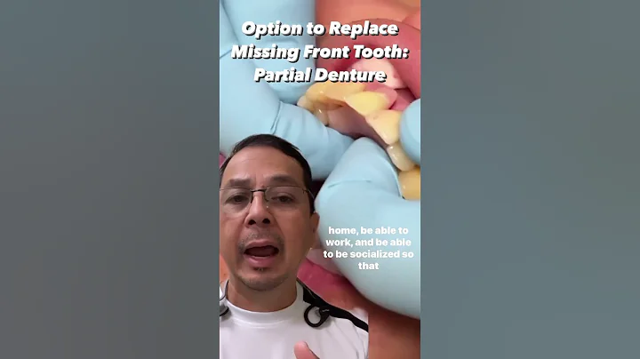 Option to Replace Missing Front Tooth (Partial Denture) | View Mobile Dental