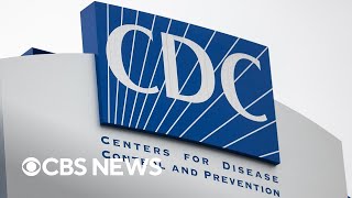 "Dual mutant" flu strains with some resistance to antiviral drug found in U.S.