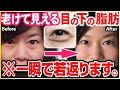 【目の下のブヨブヨ脂肪】1週間で消える！すっきり目元になる魔法の「眼輪筋ストレッチ」