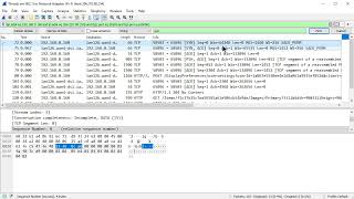 Celebrity A Quick Note About TCP MSS Net Worth
