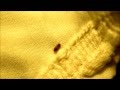 Varied Carpet Beetle Larvae, Anthrenus verbasci, Your Home