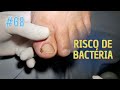 RISCO DE BACTÉRIA ( "NAIL LOVERS" )#PODOLOGOMAURELIO #PODOLOGIA#UNHAENCRAVADA