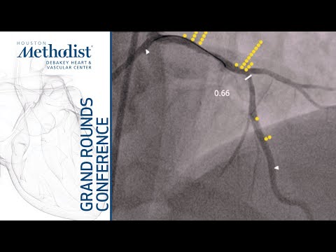 Interventional Cardiology (Neal