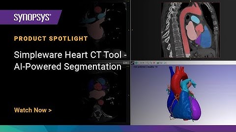 Simpleware Heart CT Tool: AI-Powered Segmentation