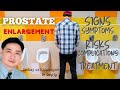 Prostate Enlargement (Benign Prostatic Hyperplasia - BPH) - Dr. Gary Sy