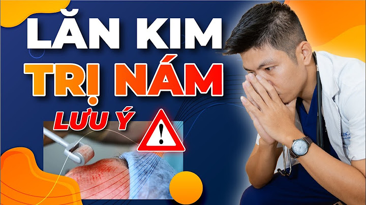 Phương pháp lăn kim bao nhiêu tiền