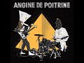 Angine De Poitrine Utzp 