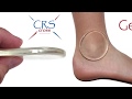 Ankle gel discs  crs cross