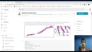 kaggle PANDA competition video 4 CNN model - Image patch creation