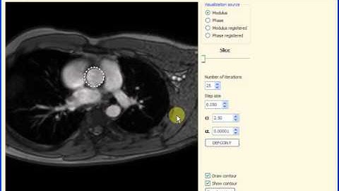 Active Contours in Optical Flow Fields for Image Sequence Segmentation