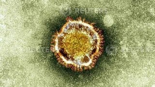 Fransa'da corona virüsü alarmı Resimi