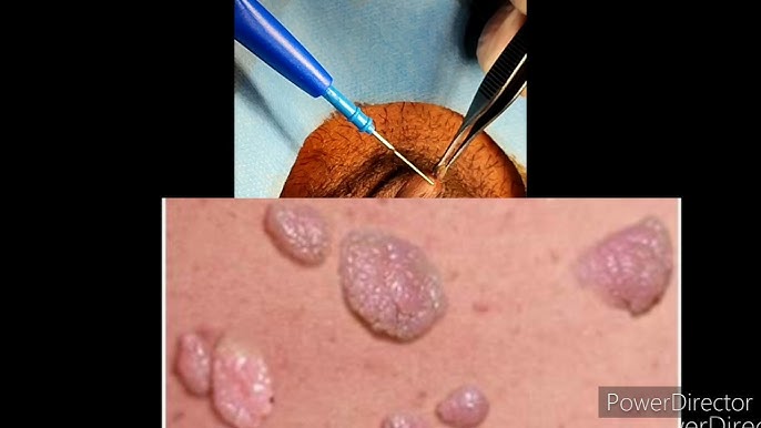 Qizda juda kop sperma Qizda juda kop sperma