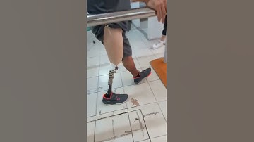 Transfemoral gait #amputee #shorts #prosthesis