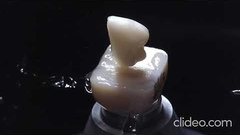 CEREC Tessera Workflow - Dr John Pasicznyk