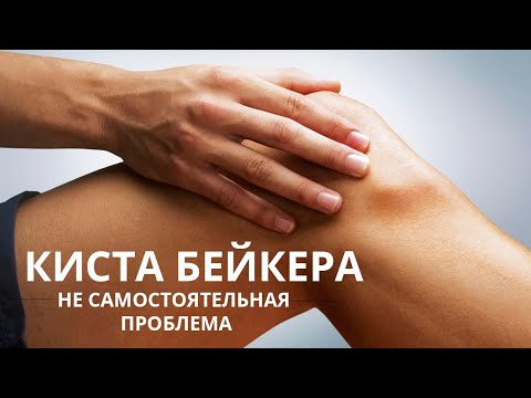 Киста Бейкера - избавляемся от неё и предупреждаем разрушение сустава.