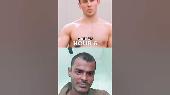 He Couldn't Move His Arm For a Week👌👌👌 #motivation #90daybodytransformation #reversetime