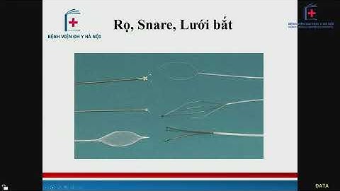 Nội soi can thiệp dị vật đường tiêu hóa trên I BV Đại học Y Hà Nội