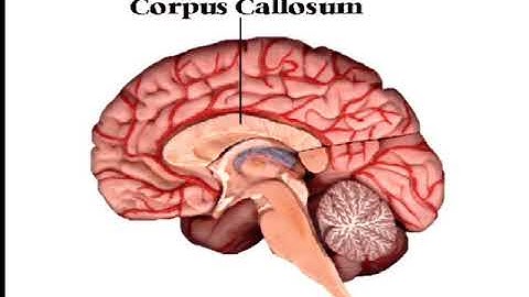 2014 09 05   Brain Bisection and Unity of Consciousness