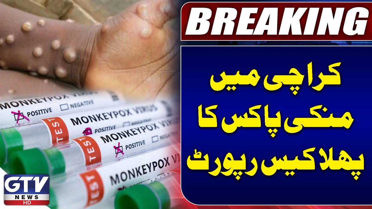 First Monkeypox Case Reported In Karachi | Monkey Pox Virus In Pakistan ...