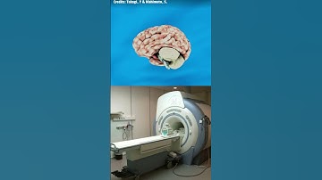 This AI Can Read Minds