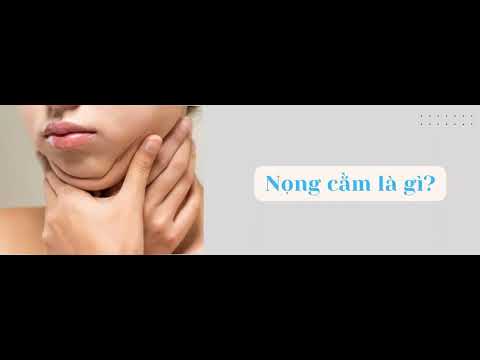 Vì sao lại có nọng cằm? Những nguyên nhân gì dẫn đến nọng cằm? - youtube