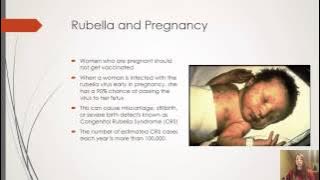 Rubella Disease Presentation