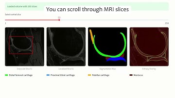 KneeXNet-2.5D: An Explainable AI for 2.5D Knee MRI Segmentation