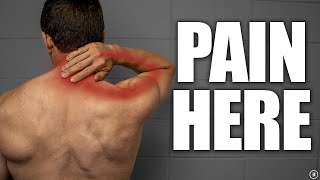 Cervical Radiculopathy | “Pinched” Nerve in Neck Rehab (Education | Exercises | Surgery | Myths)