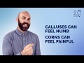Understand and Manage: Corns &amp; Calluses