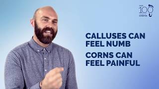 Understand and Manage: Corns &amp; Calluses