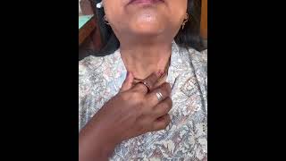 Nack Mage Apple Adom Nack Pin Nack থক