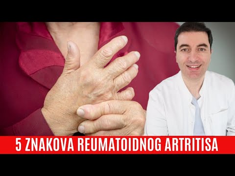 Video: Artritis Kod Mačaka - Prepoznavanje Znakova Artritisa I Liječenja Artritisa