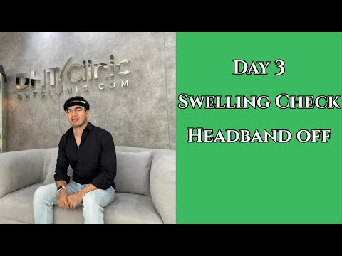 Quick Day 3 Update + Outtakes | FUT/FUE Combo Hair Transplant | DHT Clinic (Bangkok)