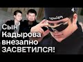 🤨 Почему Путин боится Кадырова? Глава Чечни опух и еле открывает глаза, но готовит план?