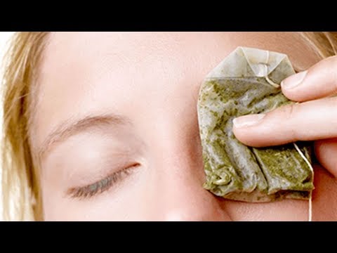 Como Curar Un Orzuelo Rapido - Como Eliminar Un Orzuelo Rapido