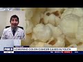 FOX 5 | Medical Oncologist Dr. Ankit Madan shares ways to lower colon cancer risk