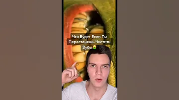 Что будет, если перестанешь чистить зубы #shorts