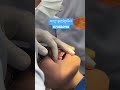 ពេទ្យធ្មេញខ្មែរធីស / Khmer teeth dental clinic in Phnom Penh