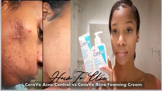How to use✨ CeraVe Acne Control Cleanser vs CeraVe Acne Foaming Cream Cleanser 🙌🏾 30 Day Review
