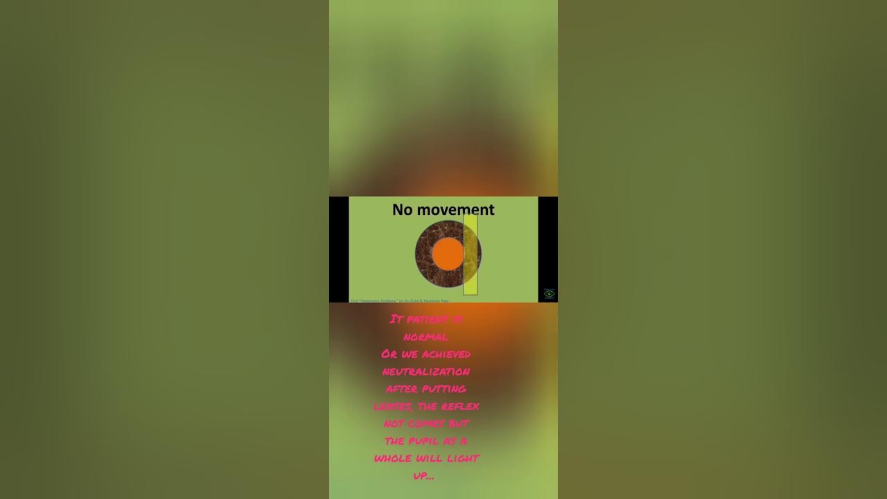 Retinoscope and Retinoscopy... YouTube