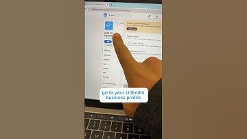 HOW TO GAIN LINKEDIN FOLLOWERS FOR YOUR BUSINESS! | Build You Marketing