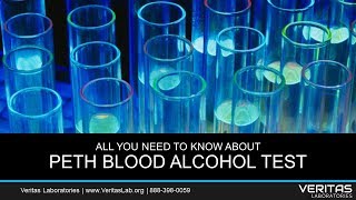 PETH Blood Alcohol Test All You Need to Know FAQ