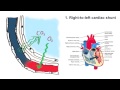 Respiratory Failure