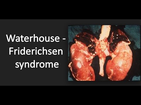 Waterhouse--Friderichsen syndrome (WFS)