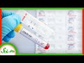 Why Don't We Have Better and Faster COVID-19 Tests? | SciShow News