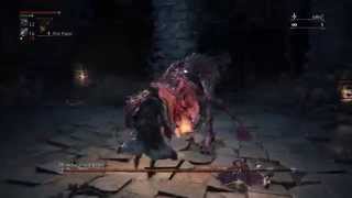Bloodborne™ Blood Starved Beast Boss Fight