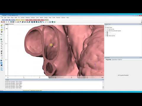 How to Eliminate Holes in Your 3D Models in 3-matic | Mimics Innovation Suite | Materialise Medical
