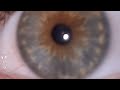 eye